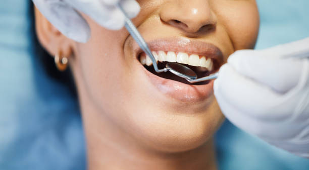 Best Emergency Root Canal Treatment in Reading, OH