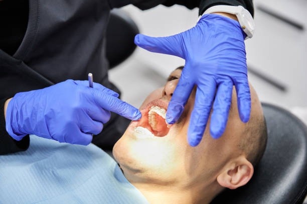 Best Emergency Broken Tooth Repair in Reading, OH